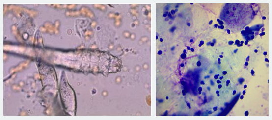 Microscopy Images - Scraping of demodex mite infestation (left) and cytology of yeast infection (right)