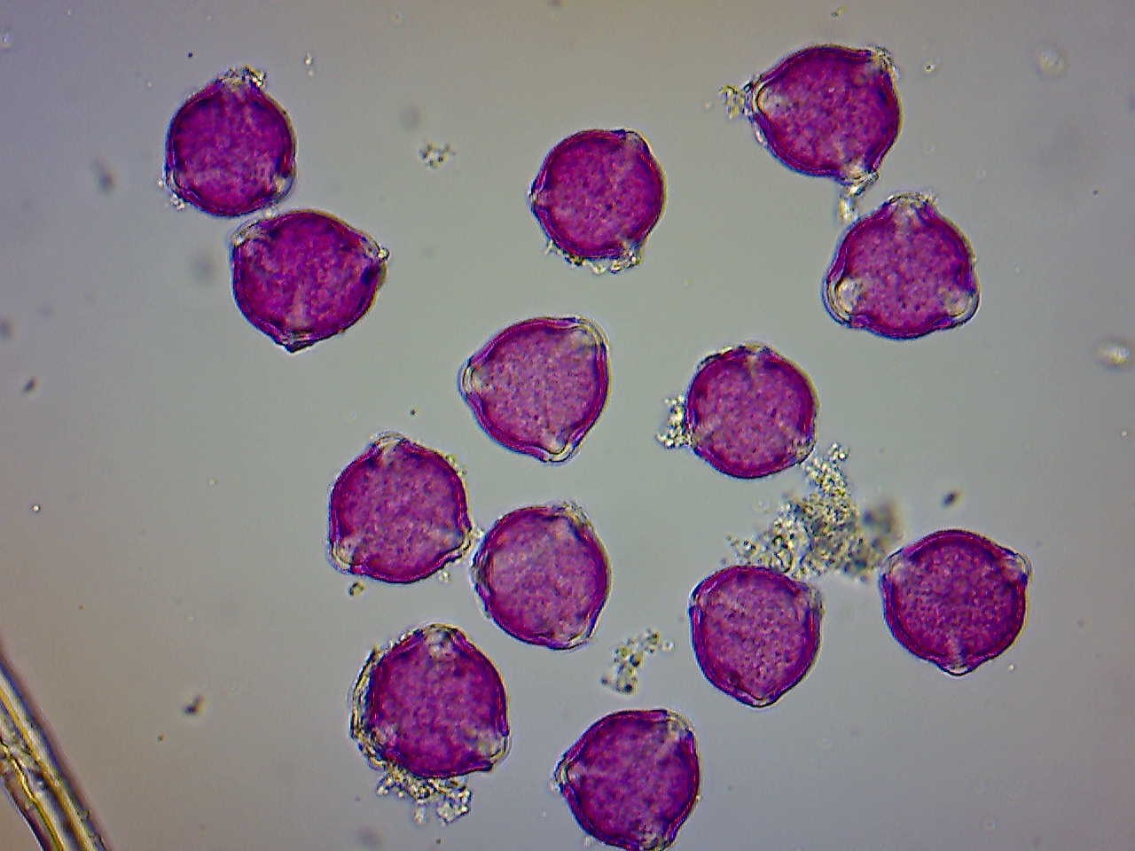 Oak Pollen Under the Microscope